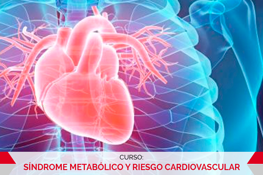 SÍNDROME METABÓLICO Y RIESGO CARDIOVASCULAR